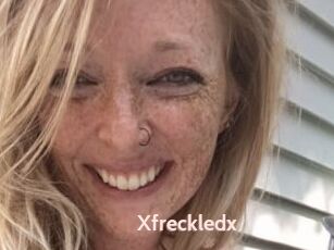 Xfreckledx